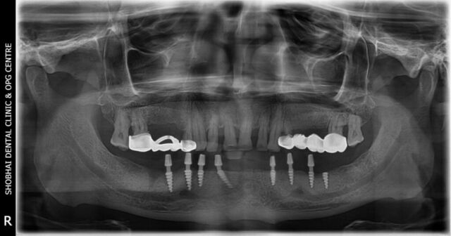 jayant mahant post op